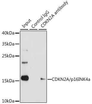 CDKN2A/p16INK4a Rabbit Polyclonal Antibody [KO Validated]