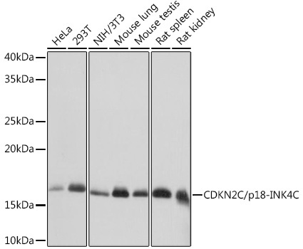 CDKN2C/p18-INK4C Rabbit Monoclonal Antibody [KO Validated]