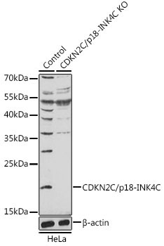 CDKN2C/p18-INK4C Rabbit Polyclonal Antibody [KO Validated]
