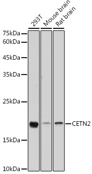 CETN2 Rabbit Polyclonal Antibody [KO Validated]