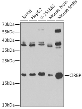 CIRBP Rabbit Polyclonal Antibody [KO Validated]