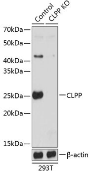 CLPP Rabbit Polyclonal Antibody [KO Validated]