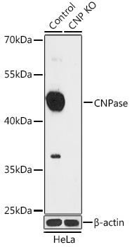 CNPase Rabbit Polyclonal Antibody [KO Validated]