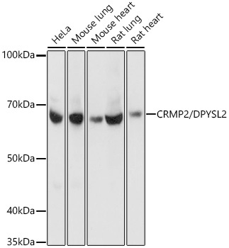 CRMP2/DPYSL2 Rabbit Monoclonal Antibody [KO Validated]