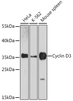 Cyclin D3 Rabbit Polyclonal Antibody [KO Validated]