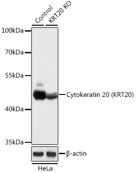Cytokeratin 20 (KRT20) Rabbit Polyclonal Antibody [KO Validated]