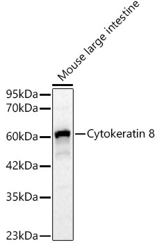 Cytokeratin 8 Rabbit Polyclonal Antibody [KO Validated]