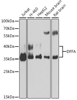 DFFA Rabbit Polyclonal Antibody [KO Validated]
