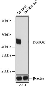 DGUOK Rabbit Polyclonal Antibody [KO Validated]