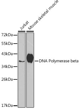 DNA Polymerase beta Rabbit Polyclonal Antibody [KO Validated]