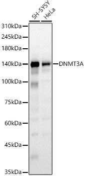 DNMT3A Rabbit Polyclonal Antibody [KO Validated]