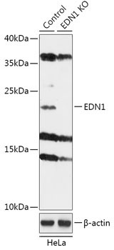 EDN1 Rabbit Polyclonal Antibody [KO Validated]
