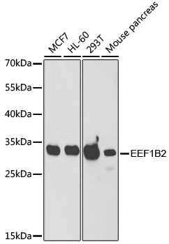 EEF1B2 Rabbit Polyclonal Antibody [KO Validated]