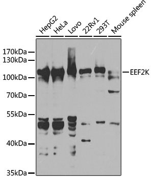 EEF2K Rabbit Polyclonal Antibody [KO Validated]