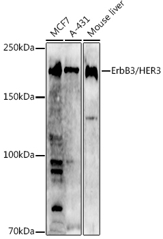 ErbB3/HER3 Rabbit Polyclonal Antibody [KO Validated]