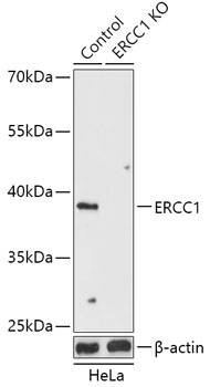 ERCC1 Rabbit Polyclonal Antibody [KO Validated]
