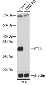 ETFA Rabbit Polyclonal Antibody [KO Validated]