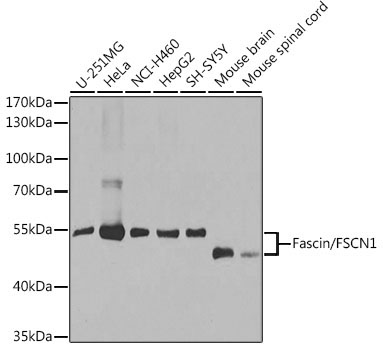 Fascin/FSCN1 Rabbit Polyclonal Antibody [KO Validated]