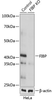 FIBP Rabbit Polyclonal Antibody [KO Validated]