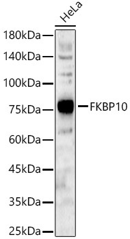 FKBP10 Rabbit Polyclonal Antibody [KO Validated]