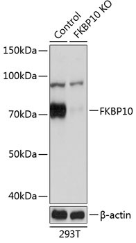 FKBP10 Rabbit Polyclonal Antibody [KO Validated]