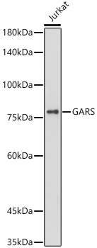 GARS Rabbit Monoclonal Antibody [KO Validated]