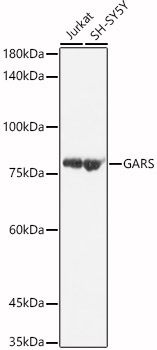 GARS Rabbit Polyclonal Antibody [KO Validated]
