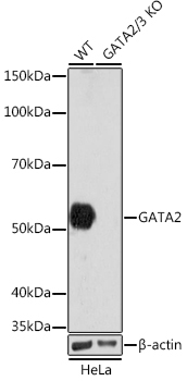 GATA2/3 Rabbit Monoclonal Antibody [KO Validated]