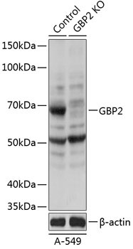 GBP2 Rabbit Polyclonal Antibody [KO Validated]