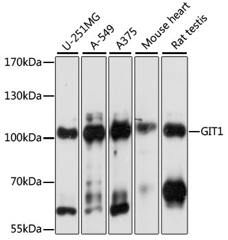 GIT1 Rabbit Polyclonal Antibody [KO Validated]