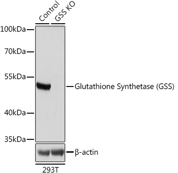 Glutathione Synthetase (GSS) Rabbit Polyclonal Antibody [KO Validated]