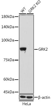 GRK2 Rabbit Monoclonal Antibody [KO Validated]