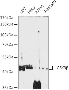 GSK3Beta Rabbit Polyclonal Antibody [KO Validated]