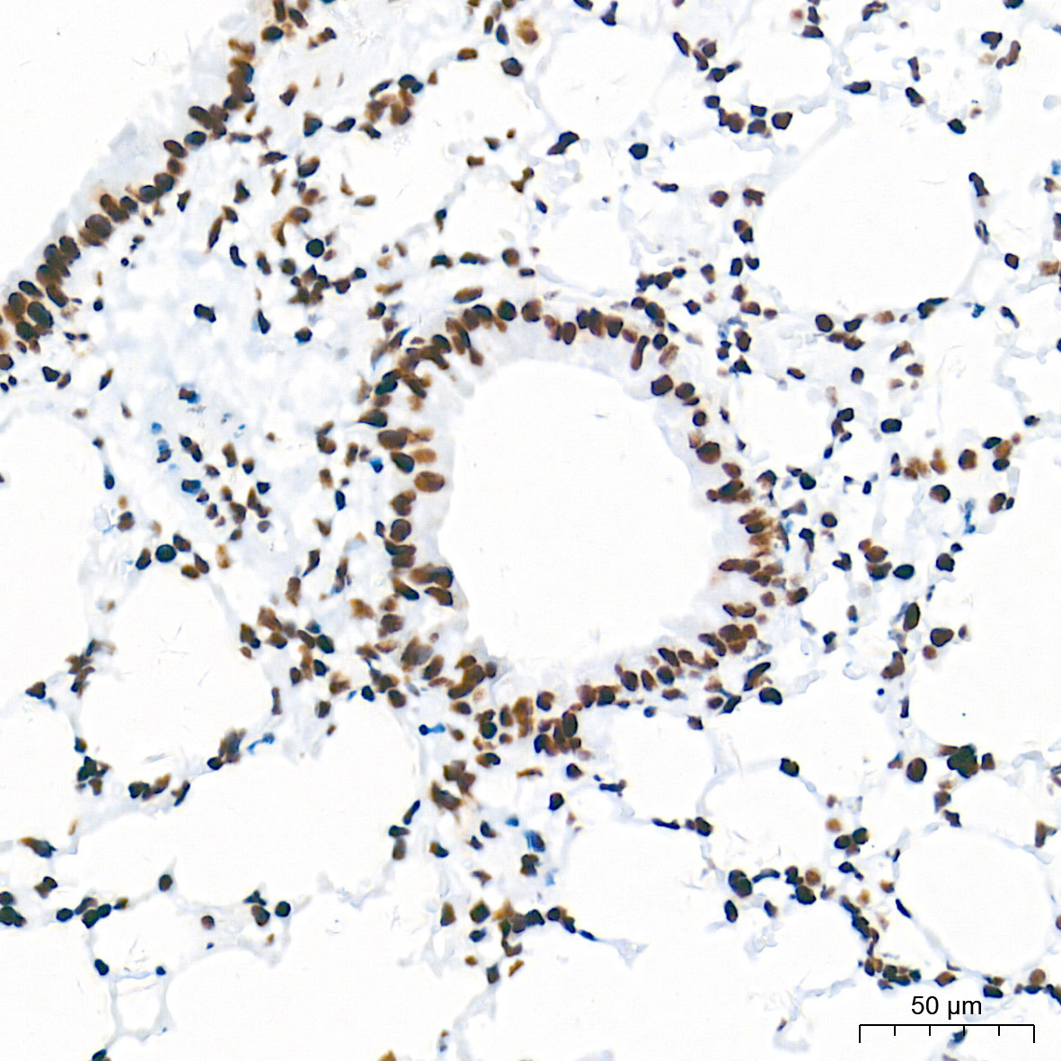 HDAC1 Rabbit Monoclonal Antibody [KO Validated]
