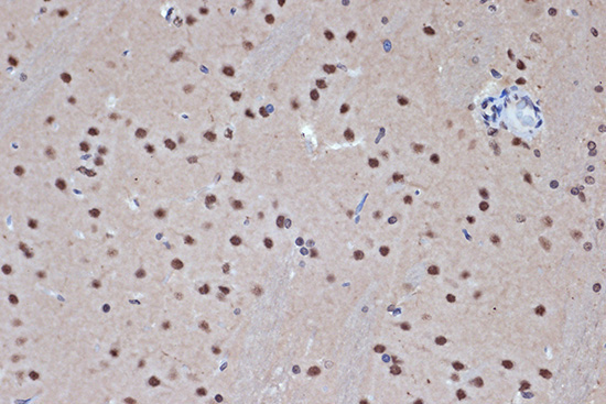 HDAC8 Rabbit Monoclonal Antibody [KO Validated]