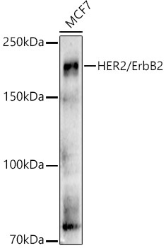 HER2/ErbB2 Rabbit Polyclonal Antibody [KO Validated]