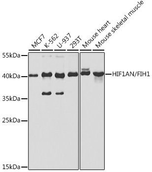 HIF1AN/FIH1 Rabbit Polyclonal Antibody [KO Validated]