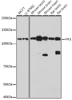 HK1 Rabbit Polyclonal Antibody [KO Validated]