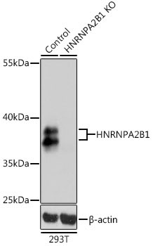 HNRNPA2B1 Rabbit Polyclonal Antibody [KO Validated]