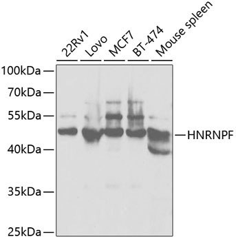 HNRNPF Rabbit Polyclonal Antibody [KO Validated]