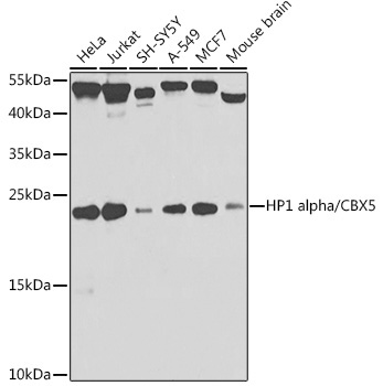 HP1 alpha/CBX5 Rabbit Polyclonal Antibody [KO Validated]