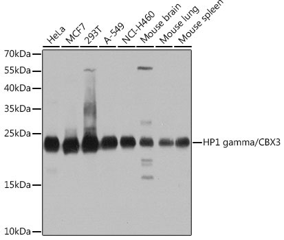 HP1 gamma/CBX3 Rabbit Polyclonal Antibody [KO Validated]