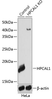 HPCAL1 Rabbit Polyclonal Antibody [KO Validated]