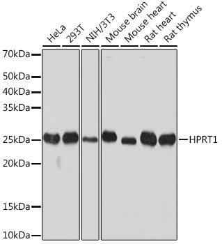 HPRT1 Rabbit Monoclonal Antibody [KO Validated]