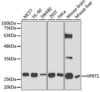 HPRT1 Rabbit Polyclonal Antibody [KO Validated]