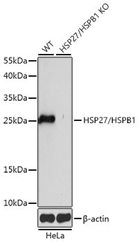 HSP27/HSPB1 Rabbit Polyclonal Antibody [KO Validated]