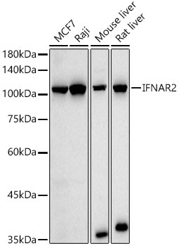 IFNAR2 Rabbit Polyclonal Antibody [KO Validated]