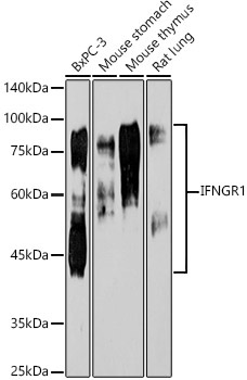 IFNGR1 Rabbit Monoclonal Antibody [KO Validated]