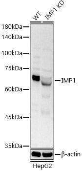IGF2BP1/IMP1 Rabbit Polyclonal Antibody [KO Validated]