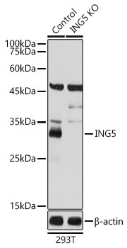 ING5 Rabbit Polyclonal Antibody [KO Validated]